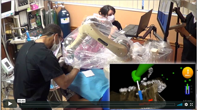 Robot-Assisted Dental Surgery IDE Video Highlights