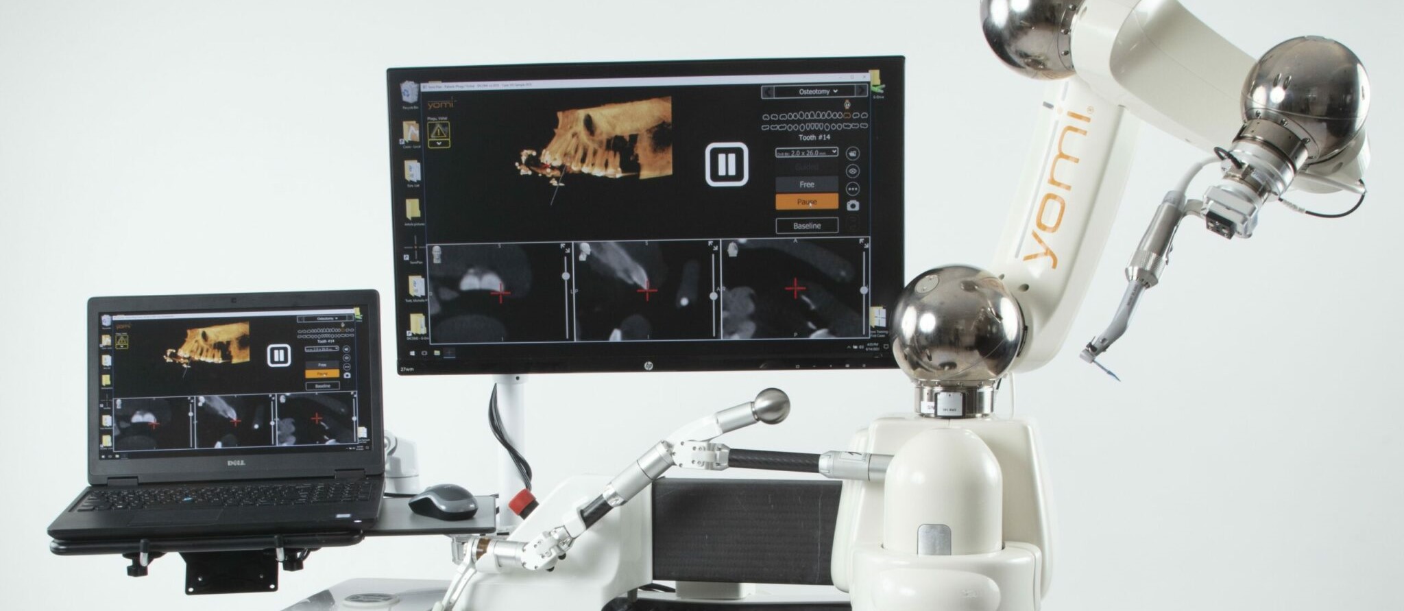 Neocis raises additional $20M in mission to revolutionize dental surgery through robotics