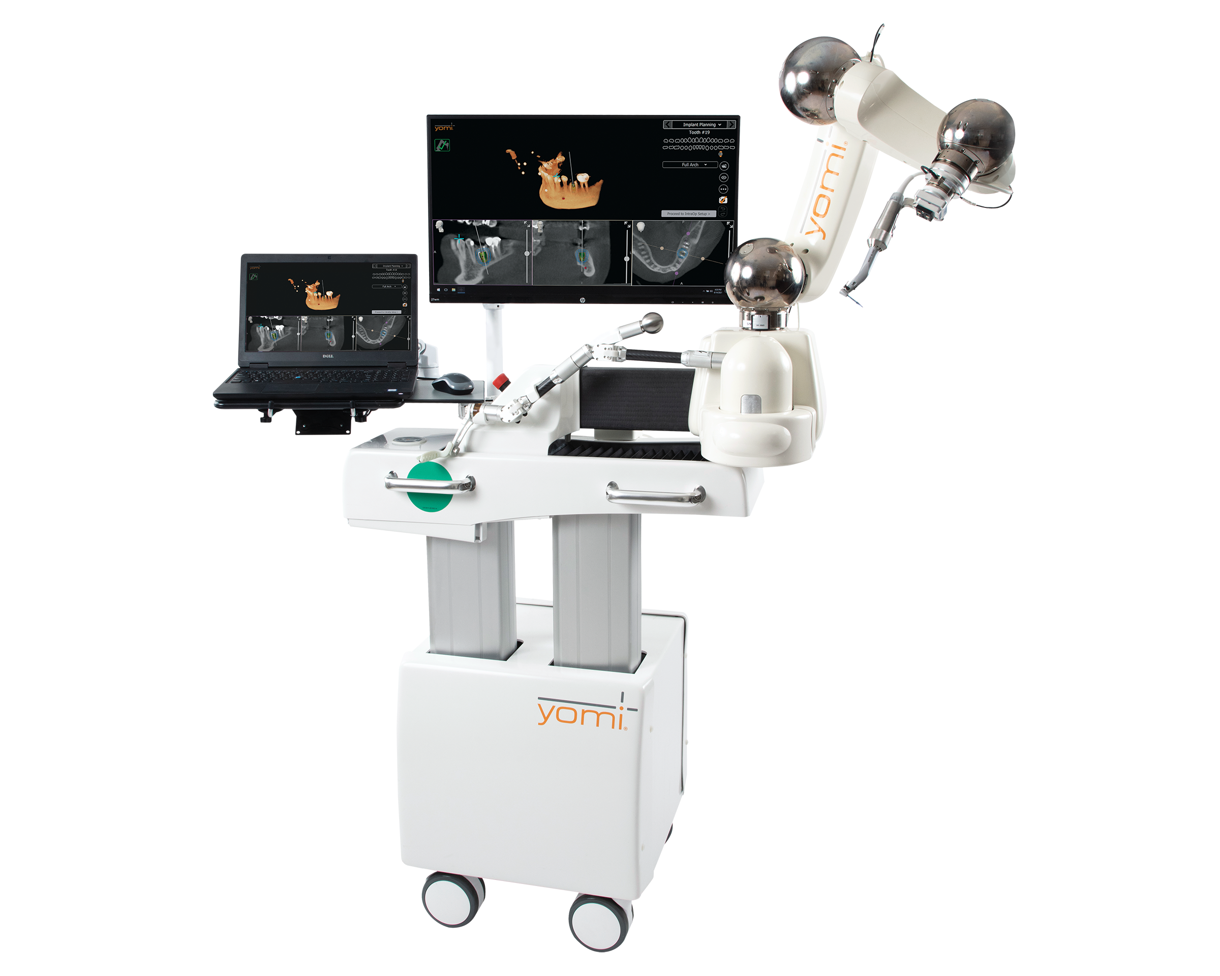 Full photo of the original Yomi dental implant robot